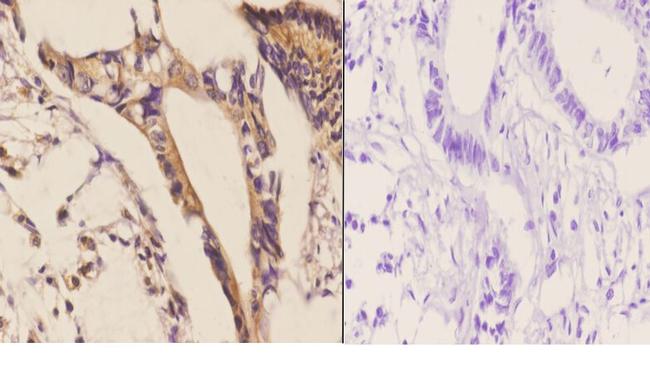 CDH17 Antibody in Immunohistochemistry (Paraffin) (IHC (P))