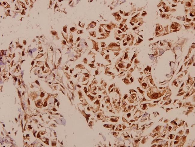 p73 Antibody in Immunohistochemistry (Paraffin) (IHC (P))