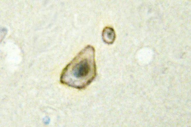 Aromatase Antibody in Immunohistochemistry (Paraffin) (IHC (P))