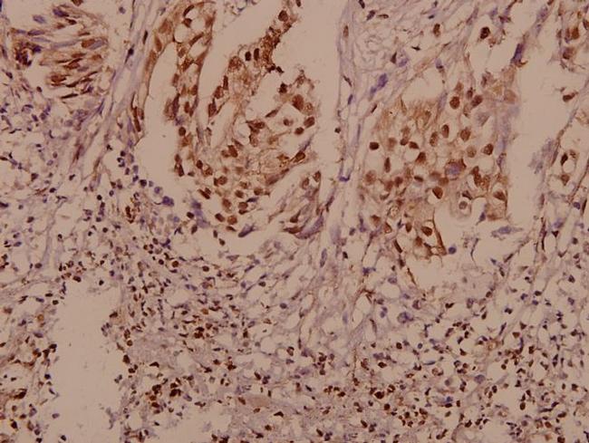 P-cadherin Antibody in Immunohistochemistry (Paraffin) (IHC (P))