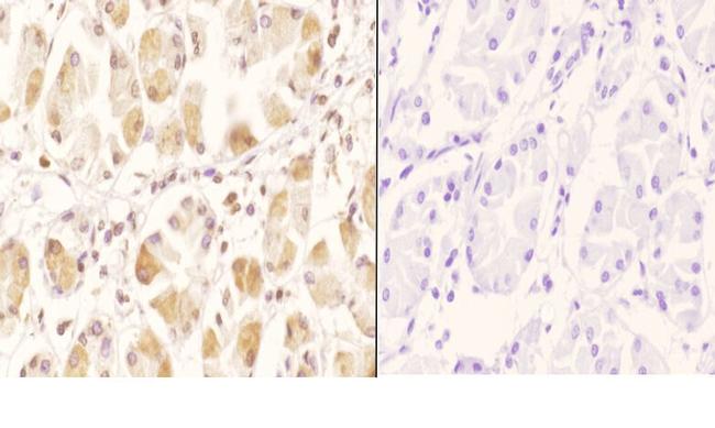 GCN5 Antibody in Immunohistochemistry (Paraffin) (IHC (P))