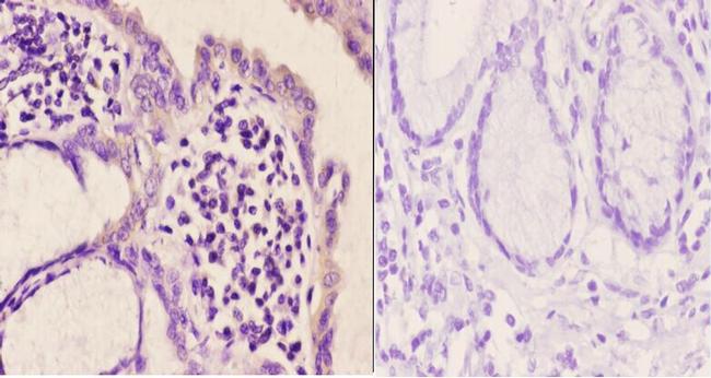 mGluR5 Antibody in Immunohistochemistry (Paraffin) (IHC (P))