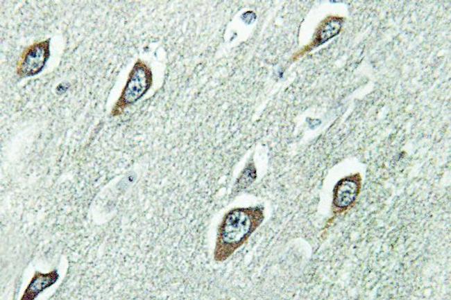 Calmodulin Antibody in Immunohistochemistry (Paraffin) (IHC (P))