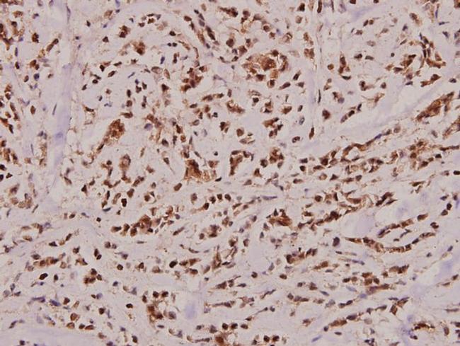 Caspase 2 Antibody in Immunohistochemistry (Paraffin) (IHC (P))