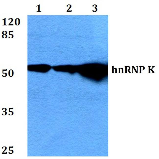 hnRNP K Antibody in Western Blot (WB)