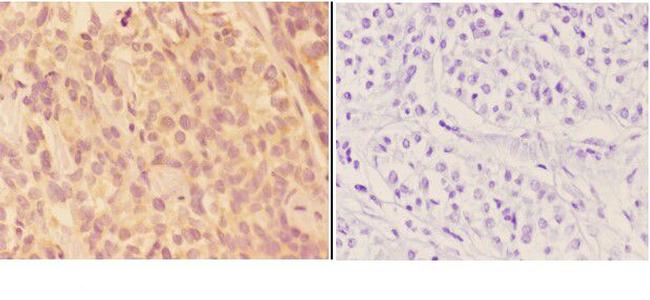 AKR1B1 Antibody in Immunohistochemistry (Paraffin) (IHC (P))