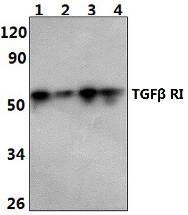 TGFBR1 Antibody in Western Blot (WB)