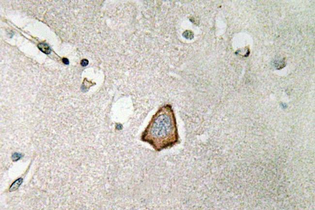 CD51 Antibody in Immunohistochemistry (Paraffin) (IHC (P))