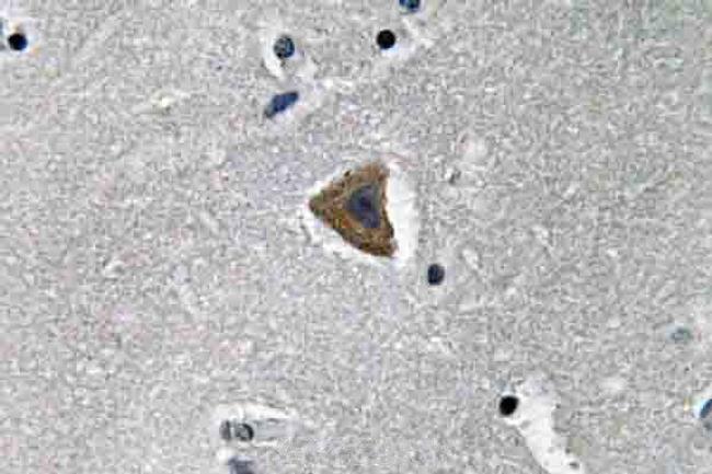 ROCK1 Antibody in Immunohistochemistry (Paraffin) (IHC (P))