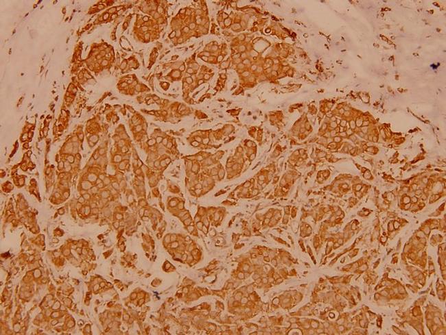 Cytokeratin 19 Antibody in Immunohistochemistry (Paraffin) (IHC (P))