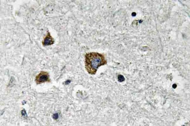 BNIP3 Antibody in Immunohistochemistry (Paraffin) (IHC (P))