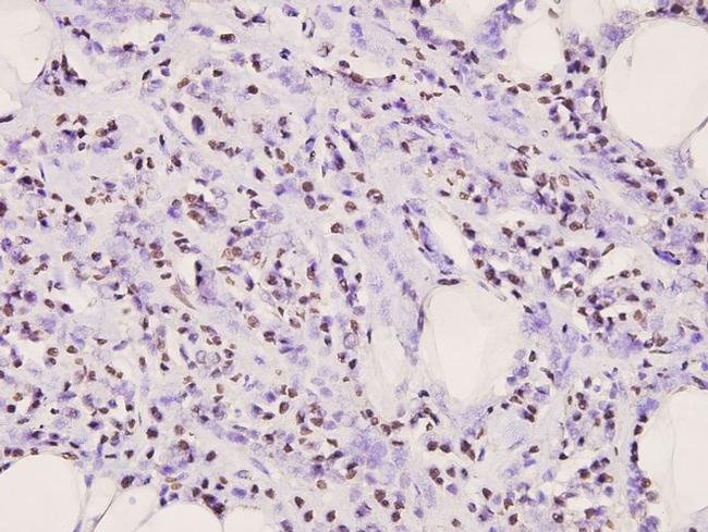 IkB alpha Antibody in Immunohistochemistry (Paraffin) (IHC (P))