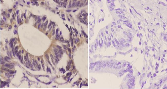 GluR2 Antibody in Immunohistochemistry (Paraffin) (IHC (P))