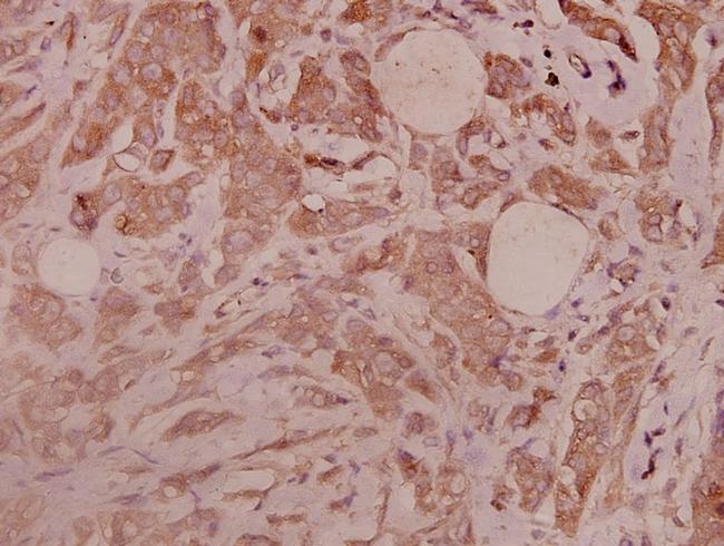 CD61 Antibody in Immunohistochemistry (Paraffin) (IHC (P))