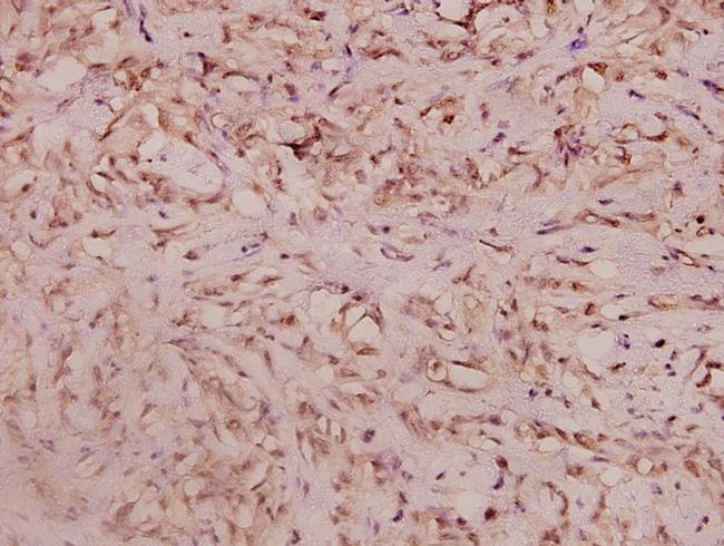 Haptoglobin Antibody in Immunohistochemistry (Paraffin) (IHC (P))