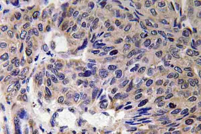 MFN2 Antibody in Immunohistochemistry (Paraffin) (IHC (P))