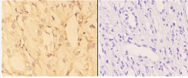 ACE2 Antibody in Immunohistochemistry (Paraffin) (IHC (P))