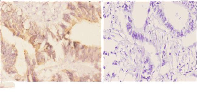 Acetylcholinesterase Antibody in Immunohistochemistry (Paraffin) (IHC (P))