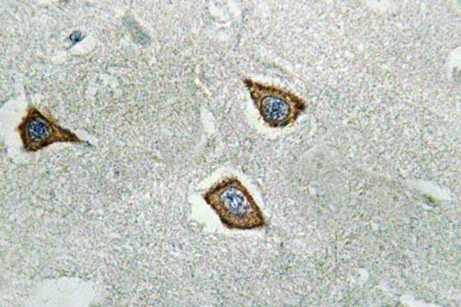 Calpain 2 Antibody in Immunohistochemistry (Paraffin) (IHC (P))