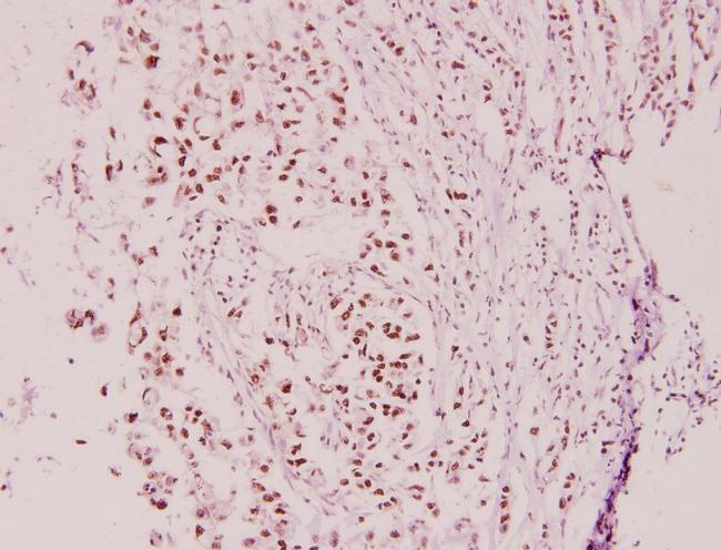 Cyclin E2 Antibody in Immunohistochemistry (Paraffin) (IHC (P))