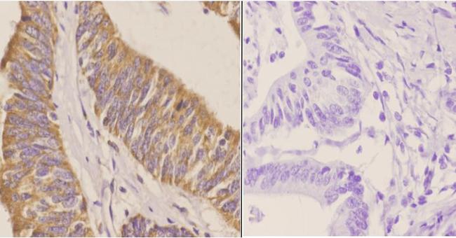 CD171 Antibody in Immunohistochemistry (Paraffin) (IHC (P))