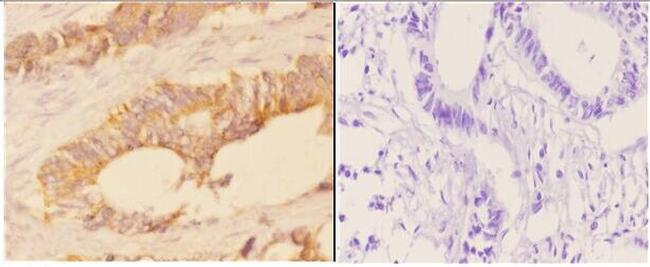 ACAT1 Antibody in Immunohistochemistry (Paraffin) (IHC (P))