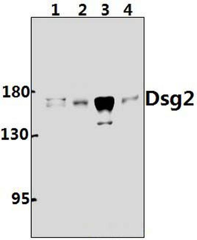 Desmoglein 2 Antibody in Western Blot (WB)