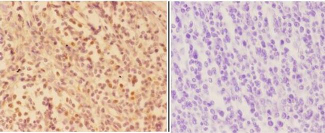 AKR1A1 Antibody in Immunohistochemistry (Paraffin) (IHC (P))