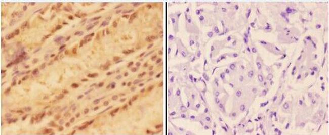 ALDH3A1 Antibody in Immunohistochemistry (Paraffin) (IHC (P))