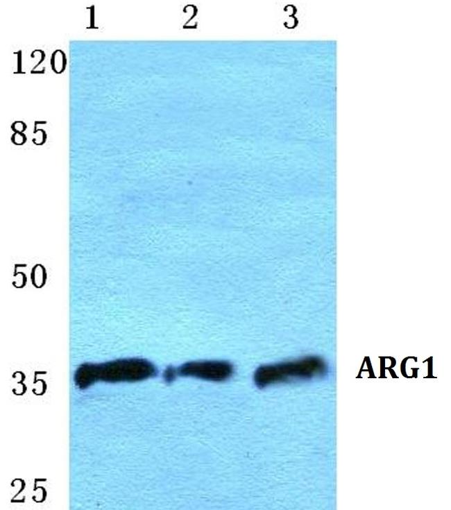 Arginase 1 Antibody in Western Blot (WB)