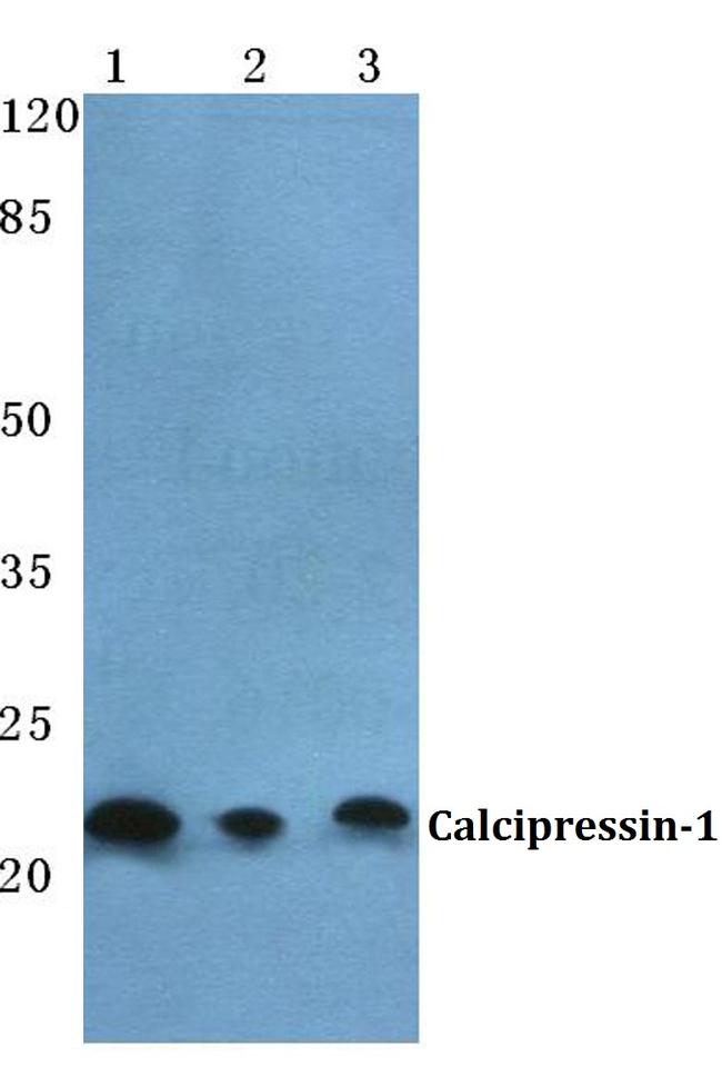 RCAN1 Antibody in Western Blot (WB)