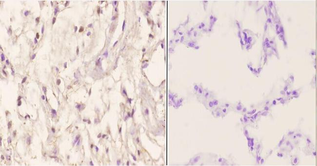 Menin Antibody in Immunohistochemistry (Paraffin) (IHC (P))