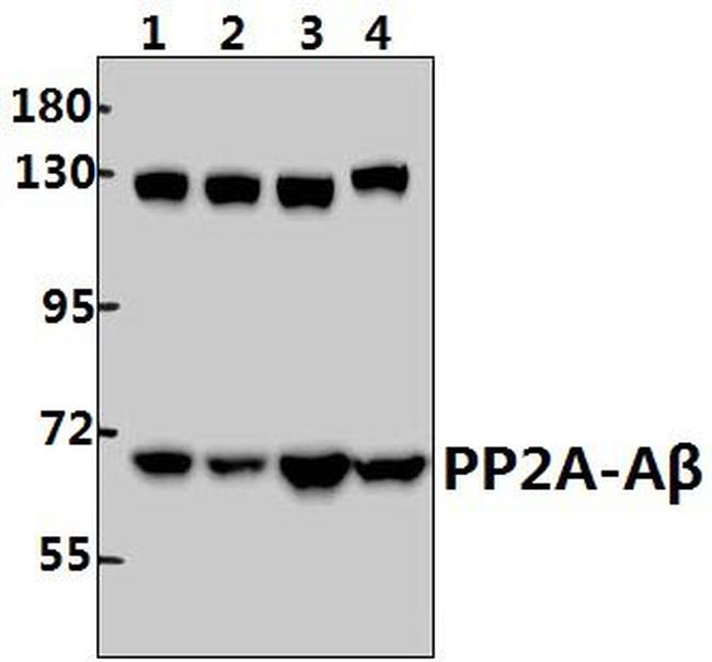 PPP2R1B Antibody in Western Blot (WB)