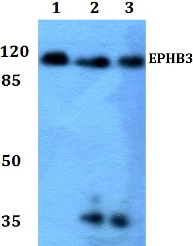 EphB3 Antibody in Western Blot (WB)