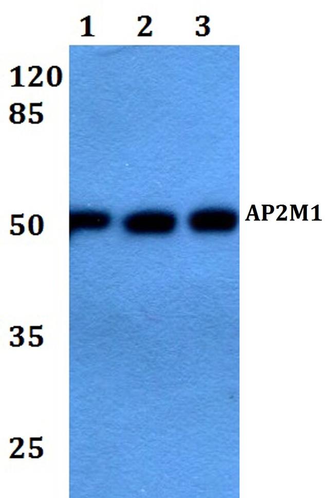 AP2M1 Antibody in Western Blot (WB)