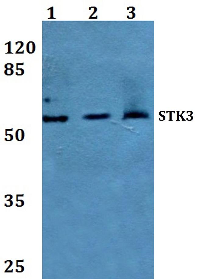 MST2 Antibody in Western Blot (WB)