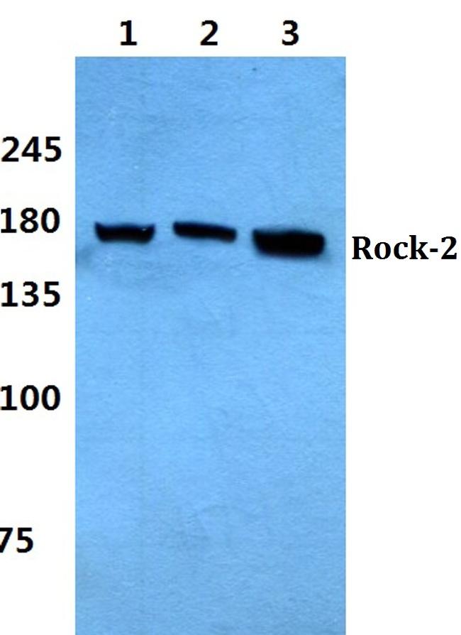 ROCK2 Antibody in Western Blot (WB)