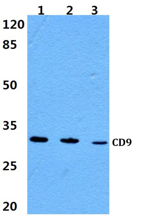 CD9 Antibody in Western Blot (WB)