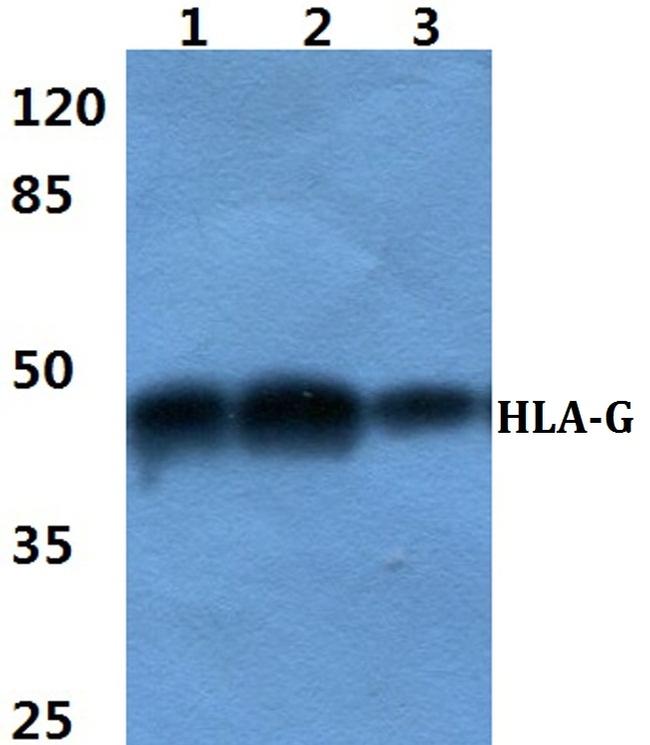 HLA-G Antibody in Western Blot (WB)