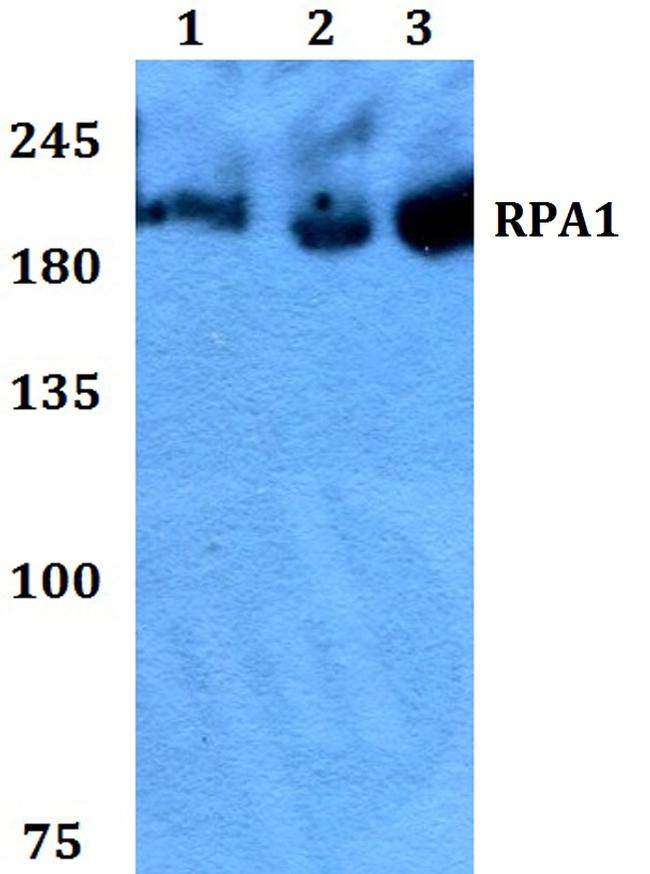 RPA70 Antibody in Western Blot (WB)