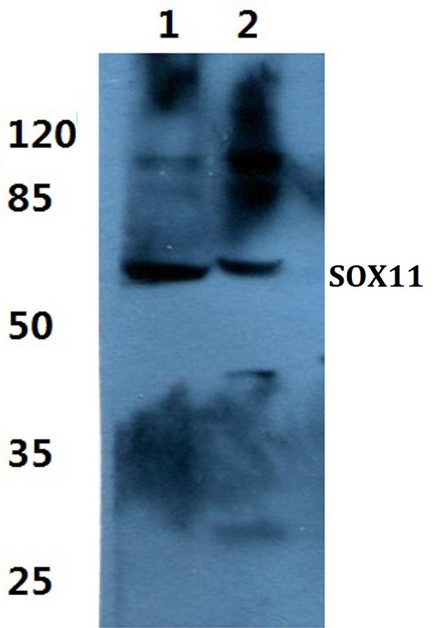 SOX11 Antibody in Western Blot (WB)