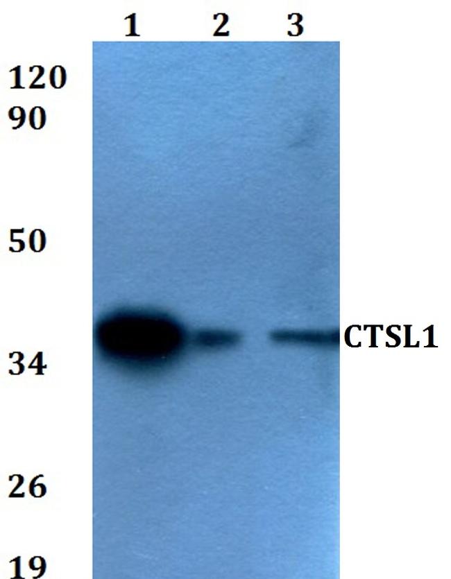 Cathepsin L Antibody in Western Blot (WB)