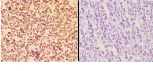 APAF1 Antibody in Immunohistochemistry (Paraffin) (IHC (P))