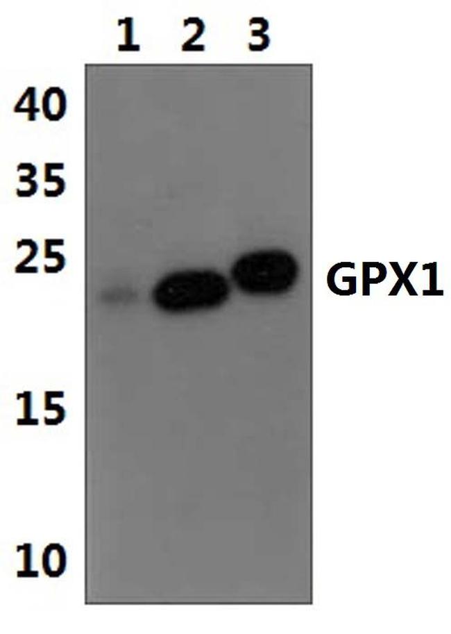 GPX1 Antibody in Western Blot (WB)