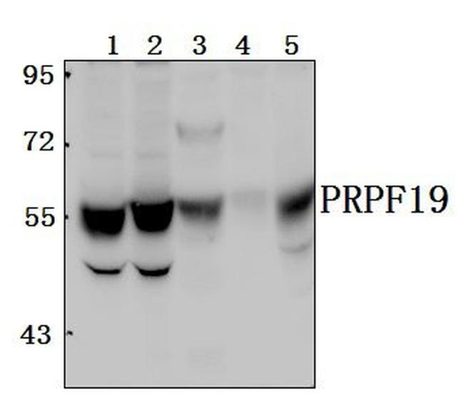 PRP19 Antibody in Western Blot (WB)