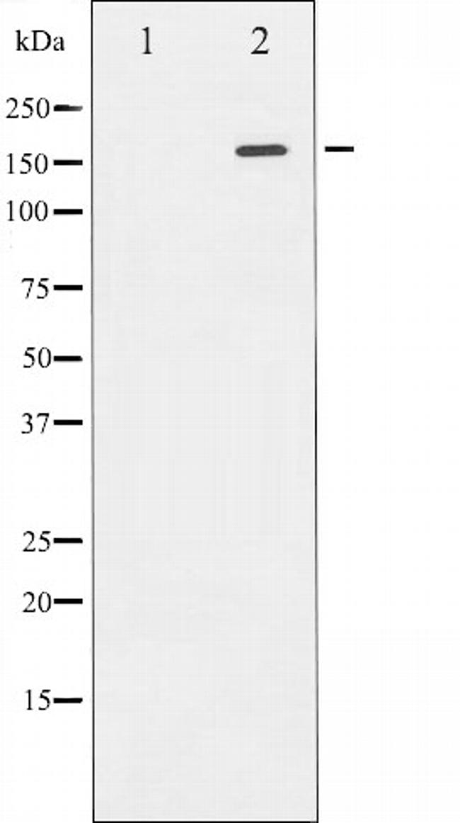 ROCK2 Antibody in Western Blot (WB)