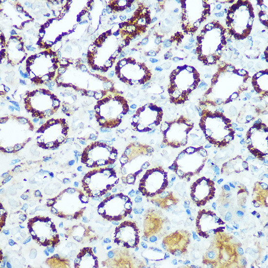 COX5B Antibody in Immunohistochemistry (Paraffin) (IHC (P))