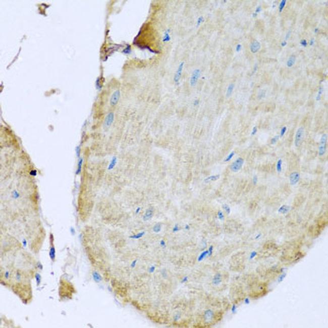 STING Antibody in Immunohistochemistry (Paraffin) (IHC (P))