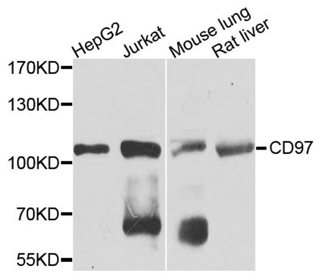 CD97 Antibody in Western Blot (WB)