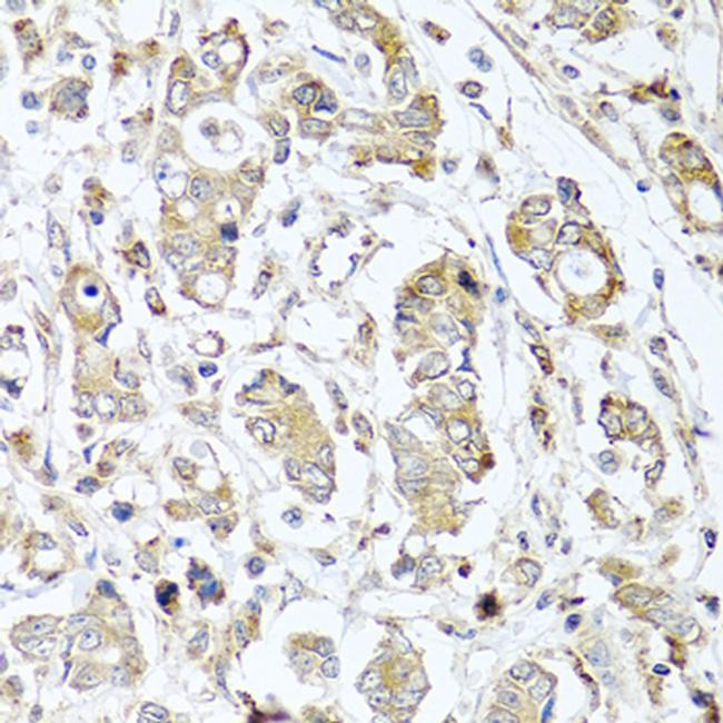 Carboxypeptidase A1 Antibody in Immunohistochemistry (Paraffin) (IHC (P))